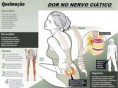 /album/dicas-de-saude/ciatico-1-jpg/